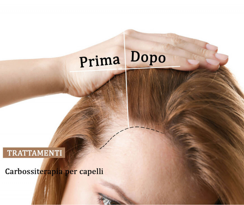 //www.medicaitalia.it/wp-content/uploads/2021/05/CAPELLI-FOTO-SITO.jpg