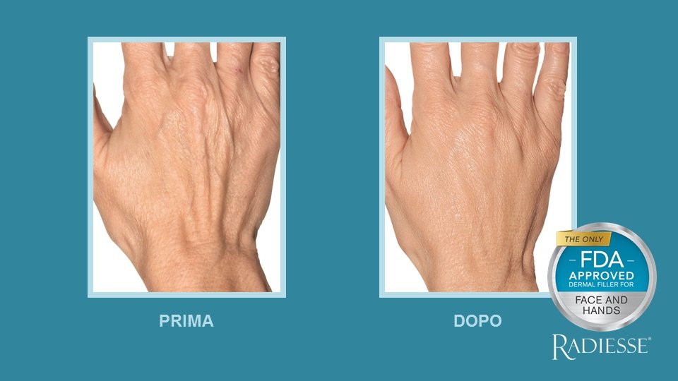 //www.medicaitalia.it/wp-content/uploads/2021/05/SEZIONE-MANI-FOTO.jpg